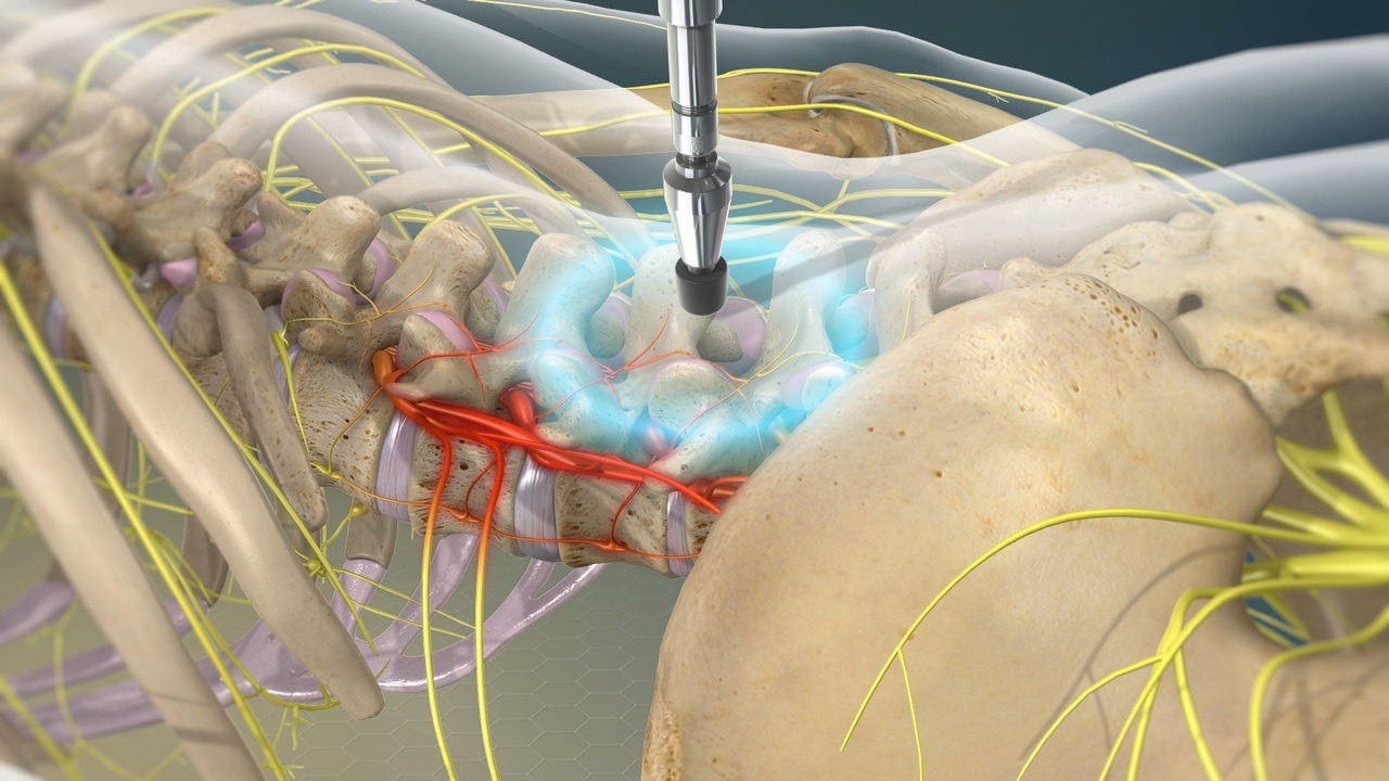 Activator Chiropractic - Anatomy Chiropractic